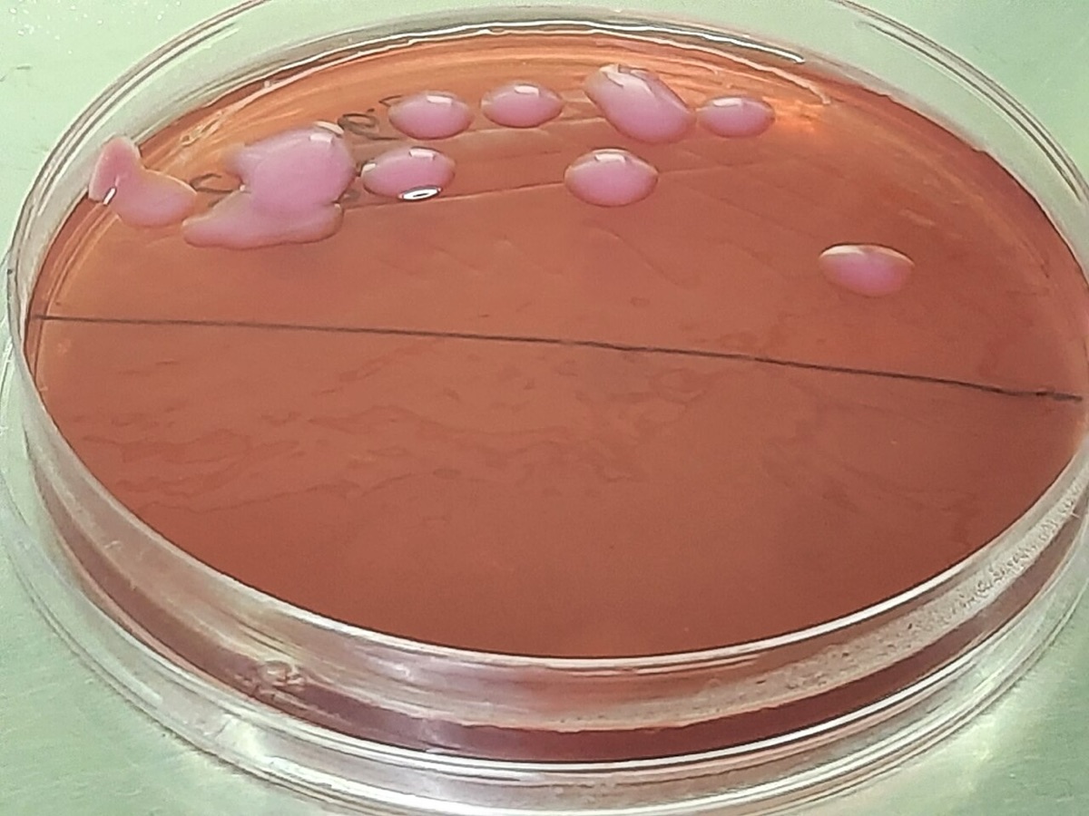 Pink, glistening, mucoid bacterial colonies on red agar in a petri dish.