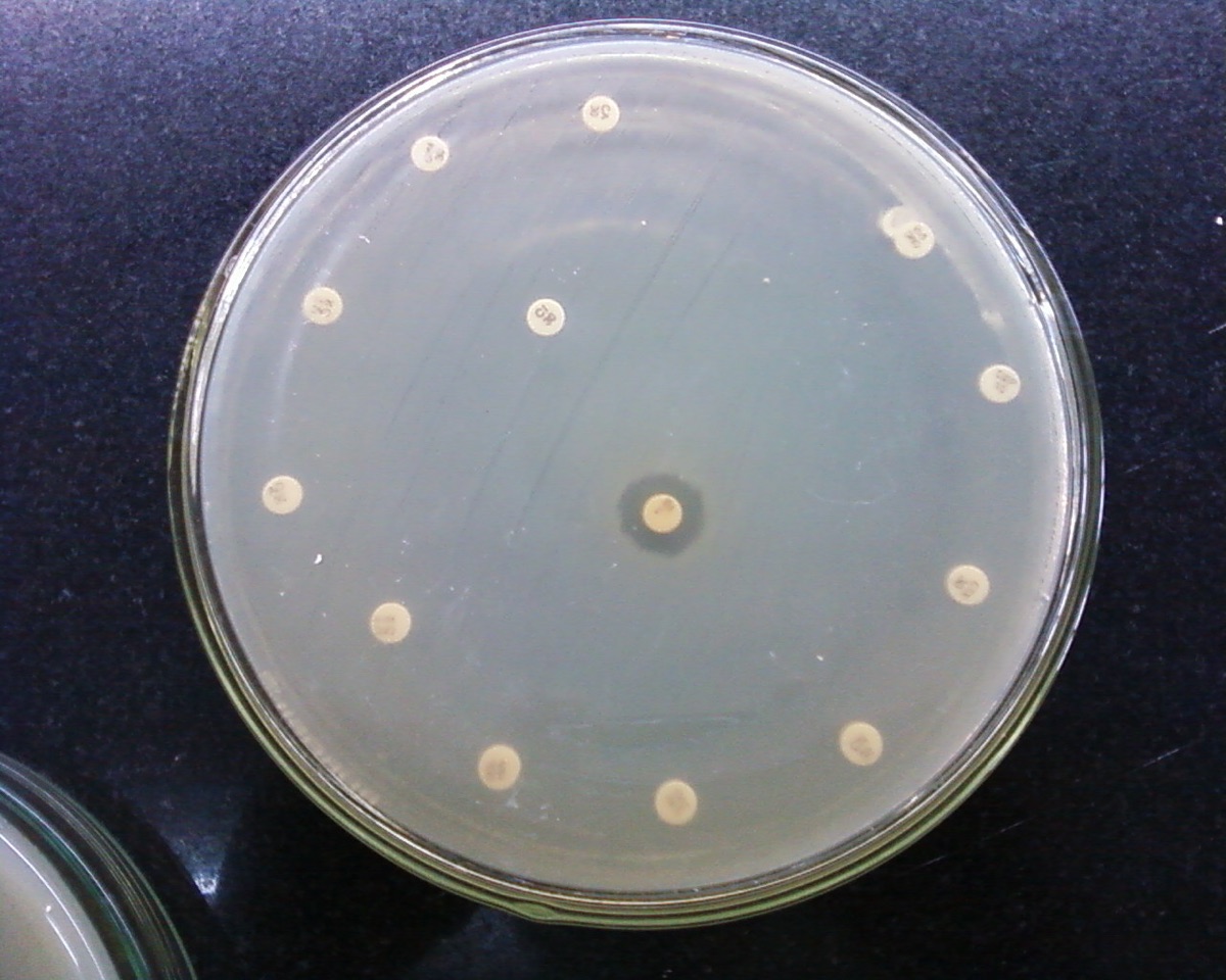 A petri dish covered evenly in bacteria, growing right up to almost every antibiotic disc.